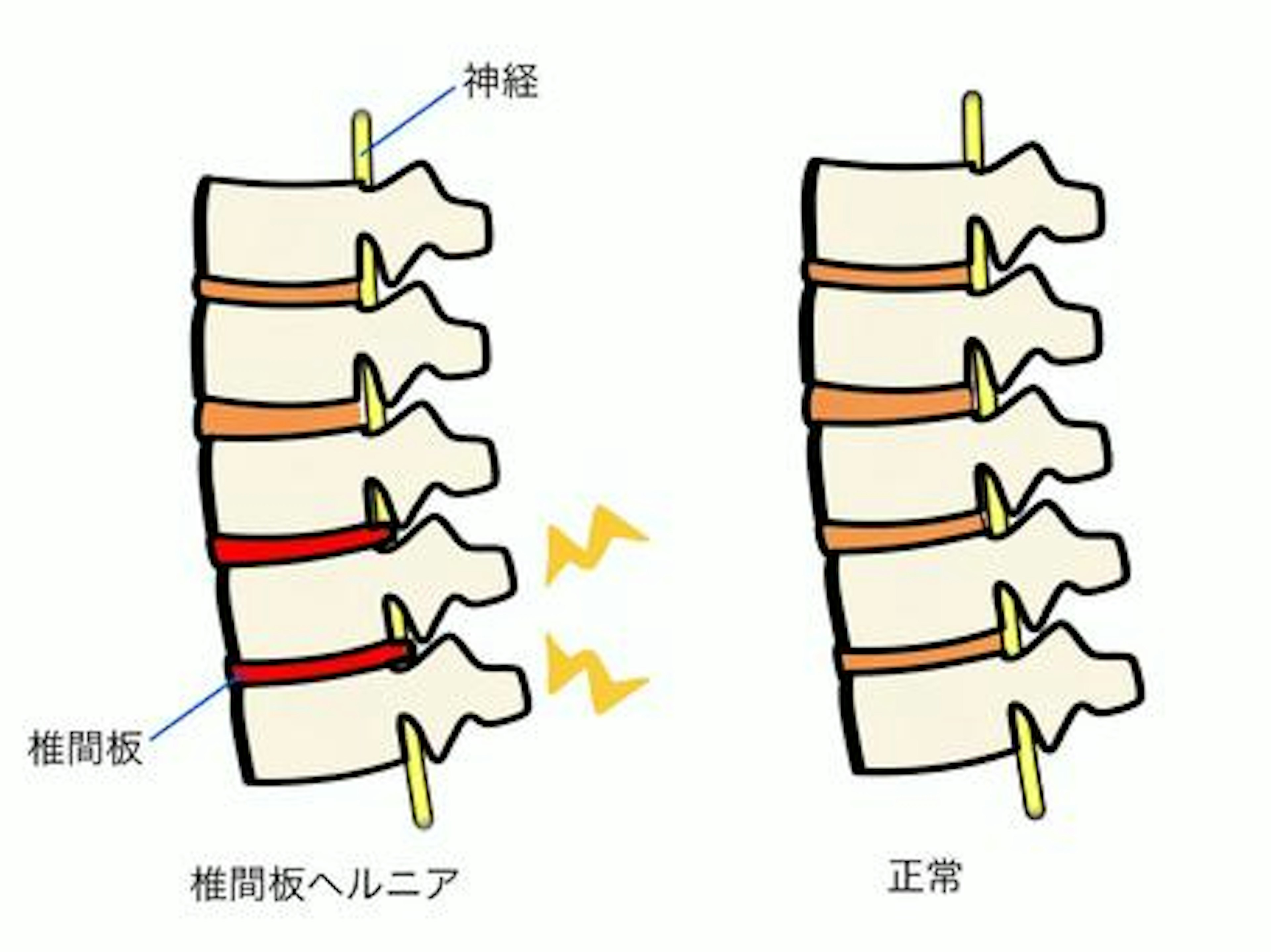 保険診療と自由診療について②　整形外科編